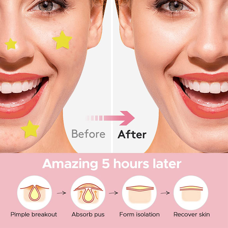600 pièces/ensemble Patchs ant - Skincare avis et prix